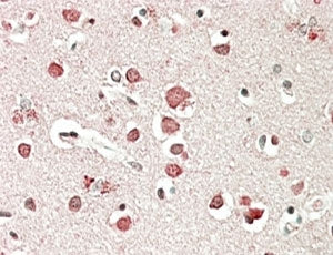 Neurobeachin Antibody