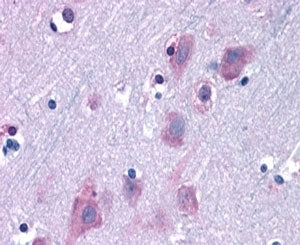 TRIM2 Antibody