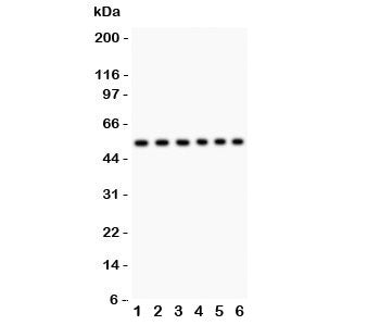 Western blot testing of CD8 antibody and Lane 1: Jurkat; 2: Raji; 3: HL-60; 4: A549; 5: COLO320; 6: