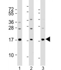 Phospholipase A2 Antibody / PLA2G2A / sPLA2