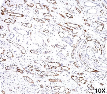 IHC testing of FFPE human kidney transplant tissue (10X) stained with C4d antibody (C4D204).
