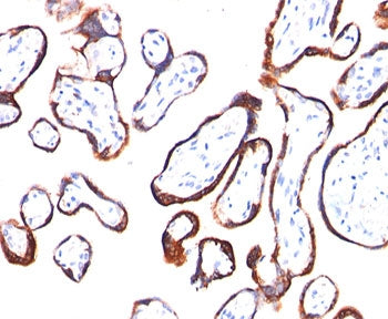 IHC testing of placenta stained with HCG-beta antibody (HCGb/54). Note specific membrane staining. H