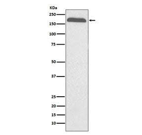 Western blot testing of human plasma lysate with Alpha-2-macroglobulin antibody. Expected molecular