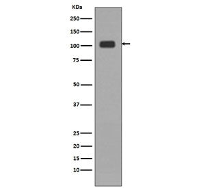 LSD1 Antibody / Lysine-Specific Demethylase 1
