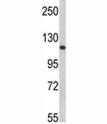 Retinoblastoma Antibody