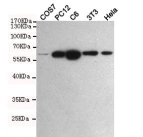 Pyruvate Kinase Antibody / PKM2