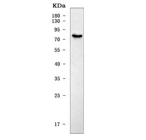 Western blot testing of mouse HEPA1-6 cell lysate with Slc22a1 antibody. Predicted molecular weight