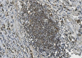 PARP1 Antibody