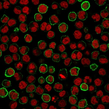 CD20 Antibody