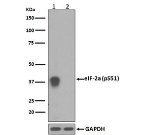 Phospho-EIF2S1 Antibody (pS51)