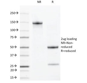 VEGF Receptor 2 Antibody / VEGFR2 / KDR