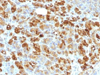 IHC testing of FFPE human pancreas with Alpha-1-Antichymotrypsin antibody cocktail (clone AACT/1451