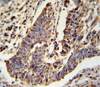 SCNN1A Antibody