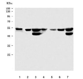 Western blot testing of 1) rat stomach, 2) rat testis, 3) rat brain, 4) mouse stomach, 5) mouse smal