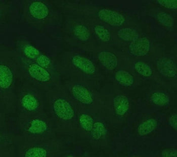 SERINC2 Antibody / Serine incorporator 2