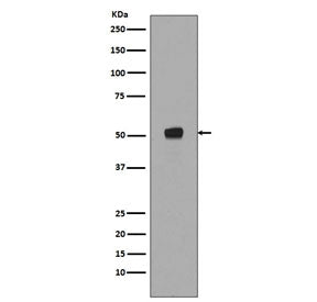 Western blot testing of lysate from human HEK293 cells treated with Calyculin A and okadaic acid, wi