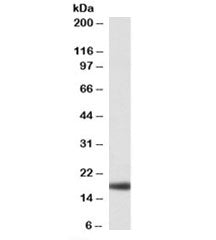 Haptoglobin Antibody