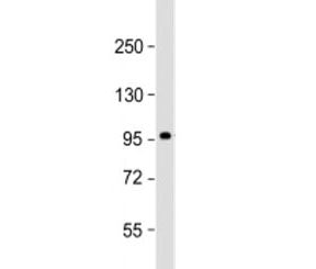 SULF1 Antibody / Sulfatase 1