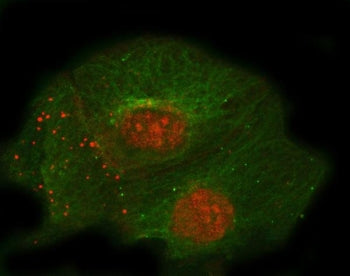 Immunofluorescent staining of FFPE human A431 cells with Thrombomodulin antibody (red) and Alpha Tub