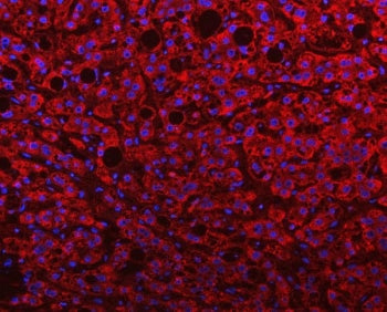 PGP Antibody / Glycerol-3-phosphate phosphatase