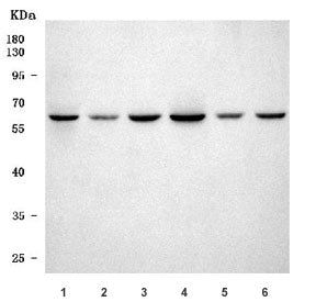 SETD3 Antibody / Actin-histidine N-methyltransferase