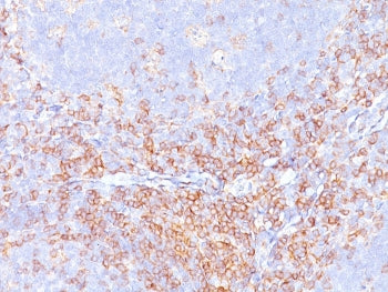 IHC staining of FFPE human tonsil with recombinant CD4 antibody. HIER: boil tissue sections in pH 9