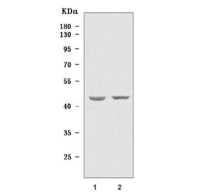 Western blot testing of human 1) Caco-2 and 2) A549 cell lysate with TIMD4 antibody. Predicted molec