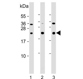CD81 Antibody