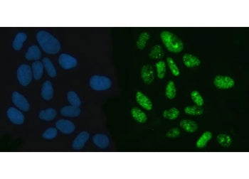 XPO5 Antibody / Exportin 5