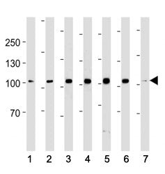 ACE2 antibody western blot analysis in (1) 293, (2) K562, (3) MCF-7, (4) SK-BR-3, (5) T47D, (6) MDA-
