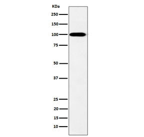 Western blot testing of human K562 cell lysate with Myosin XIX antibody. Predicted molecular weight