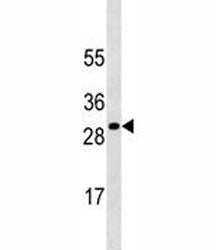 SOCS3 Antibody