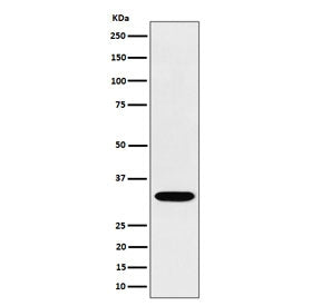 Western blot testing of human Jurkat cell lysate with TSFM antibody. Predicted molecular weight ~35
