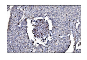 SLFN11 Antibody / Schlafen family member 11