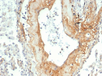 IHC staining of FFPE human lung tissue with Tenascin C antibody (clone TNC/4805). HIER: boil tissue