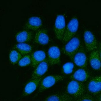 GDP-L-fucose synthase Antibody / GFUS / TSTA3