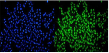 Immunofluorescent staining of FFPE human A549 cells with SMARCA2 antibody (green) and DAPI nuclear s