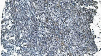 MCU Antibody / Calcium uniporter protein, mitochondrial