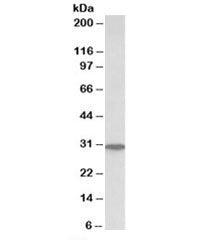 PNP Antibody