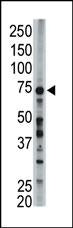 ACSL6 Antibody / FACL6