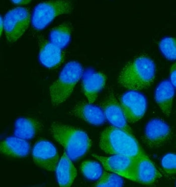 MEK7 Antibody / MAP2K7 / MKK7