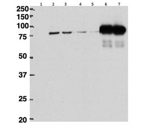 HeLa lysate either in RIPA (lanes 1, 2, 4, 6) or TX100 buffer (lanes 3, 5, 7) overexpressing mouse b
