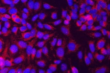 Immunofluorescent staining of FFPE human HeLa cells with MUNC18-1 antibody (red) and DAPI nuclear st