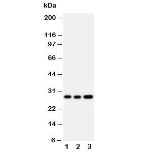 Oncostatin M Antibody