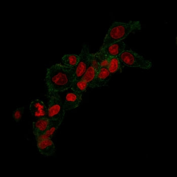 Immunofluorescent staining of methanol-fixed human SLBR3 cells with ErbB2 antibody (clone HRB2/258,