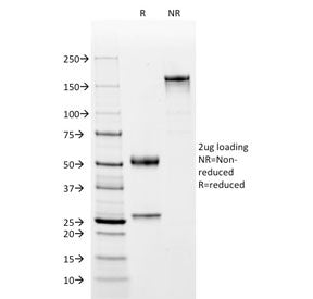 SDS-PAGE analysis of purified, BSA-free C4d antibody (clone C4D204) as confirmation of integrity and purity.