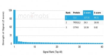 Analysis of HuProt(TM) microarray containing more than 19,000 full-length human proteins using Clust