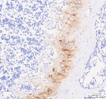 COMP Antibody / TSP5