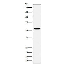 Western blot testing of human Jurkat cell lysate with PNKP antibody. Predicted molecular weight ~57
