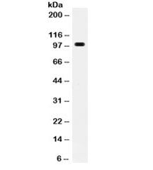 Western blot testing of mouse Hepa1-6 cell lysate with RANK antibody. Predicted molecular weight ~66
